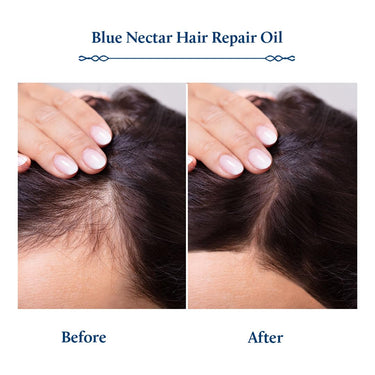 Blue Nectar Rosemary Oil for Hair Growth with Bhringraj Oil for Hair | Natural Alternate for Redensyl | Non- Sticky Ayurvedic Hair Oil with Amla Hair Oil (9 Herbs,200ml)